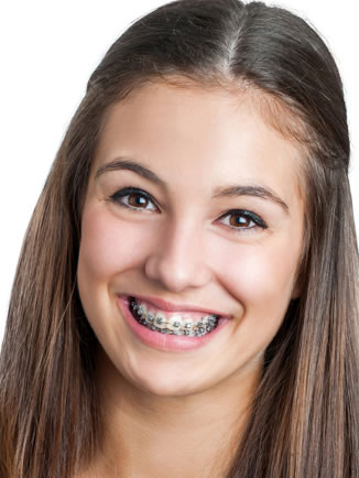 common orthodontic issues